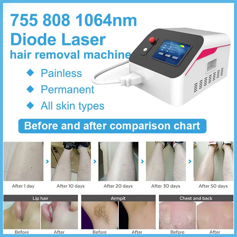 Diodenlaser-Haarentfernungsgerät, 808 nm, 3 Wellenlängen, 755 808 1064 nm, Schönheitssalonausrüstung, dauerhaftes schmerzloses Haarentferner-Gerät zur Hautverjüngungsbehandlung