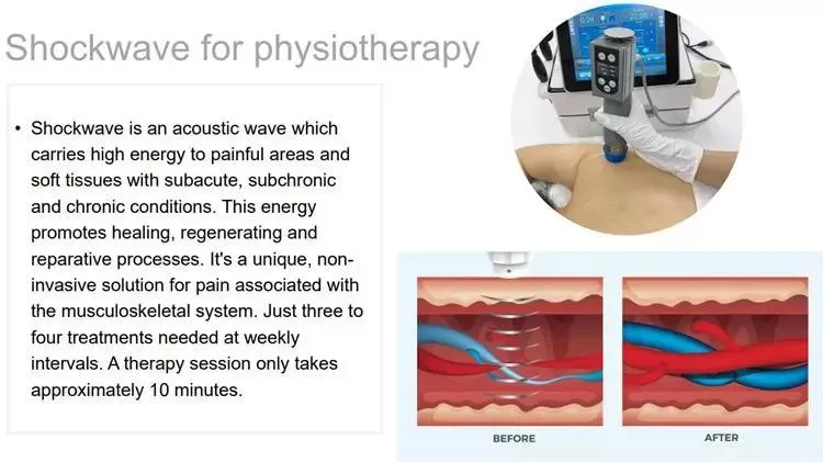 3 in 1 CET&RET Smart Tecar EMS Shock Wave Extracorporeal Focused ED Shockwave Therapy For Erectile Dysfunction Shockwave Machine