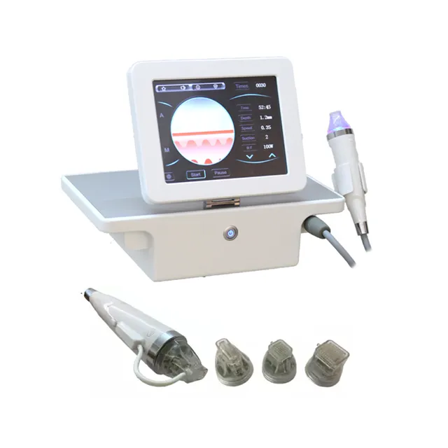 Trattamento delle smagliature con macchina microneedling a radiofrequenza Rf