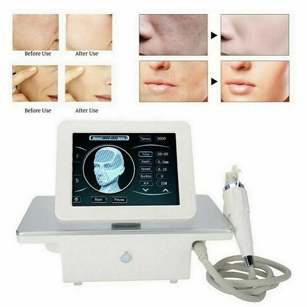 Máquina de beleza de microanedle de RF fracionária levantando a pele anti-risque anti-acne scars estrias de remoção de remoção de RF fracionária