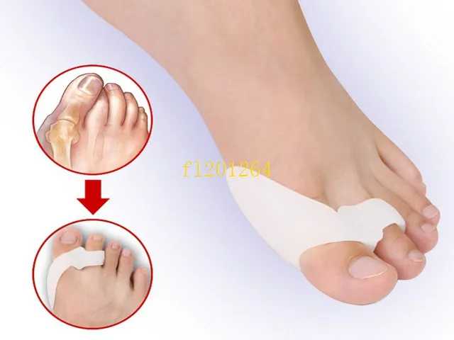 livraison gratuite pouce Hallux Valgus orthèses Correction protecteur, Gel de Silicone pied orteil séparateurs alignement Bunion