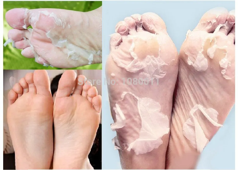 Ny 5PAIR10PCS Foot Mask Peeling Cuticles Heel Feet Care Tely Baby Bamboo Vinäger Ta bort död hudmjölk