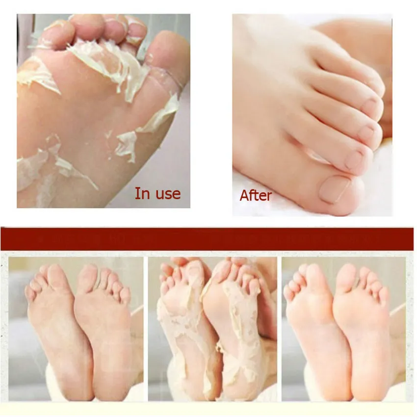 Exfoliating Foot Strumps Mask Care Peeling Vinäger Ta bort död hud Smooth Baby Feet