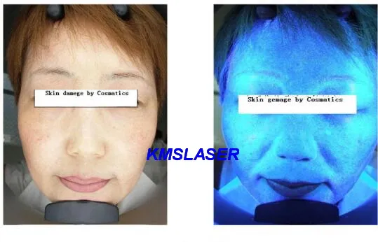 12.0 메가 픽셀 휴대용 매직 미러 피부 분석기 얼굴 피부 분석 기계 미용 장비 페이셜 장비 스킨 스캐너 분석기