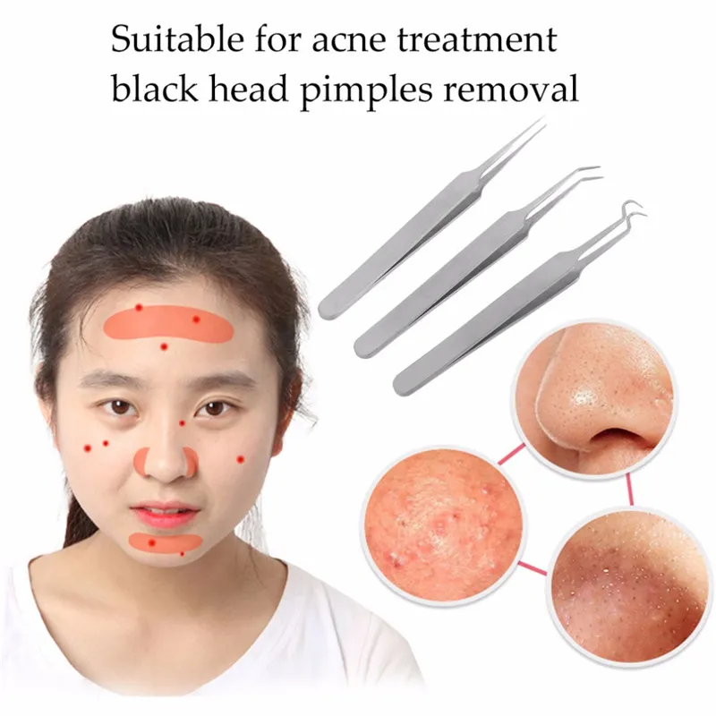 DHgate.com:2024 Tamax Precision Acne Needle Tweezers for Blackhead ...