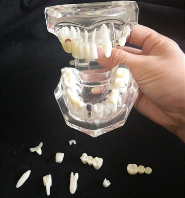 VENDITE CALDE Igiene orale denti in plastica di dimensioni naturali modello di denti rimovibili