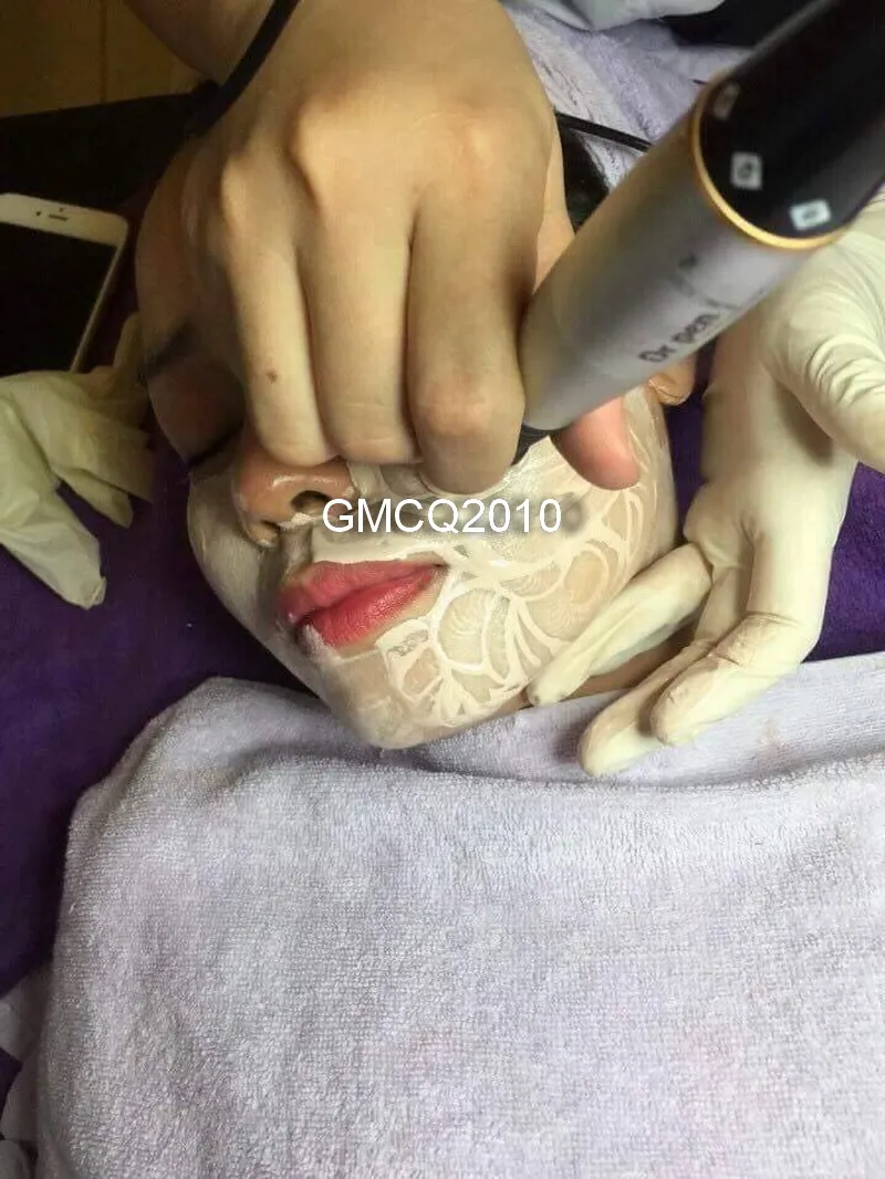 Kablosuz DermaPen Şarj Edilebilir Derma Pen Dr.Pen Microneedling