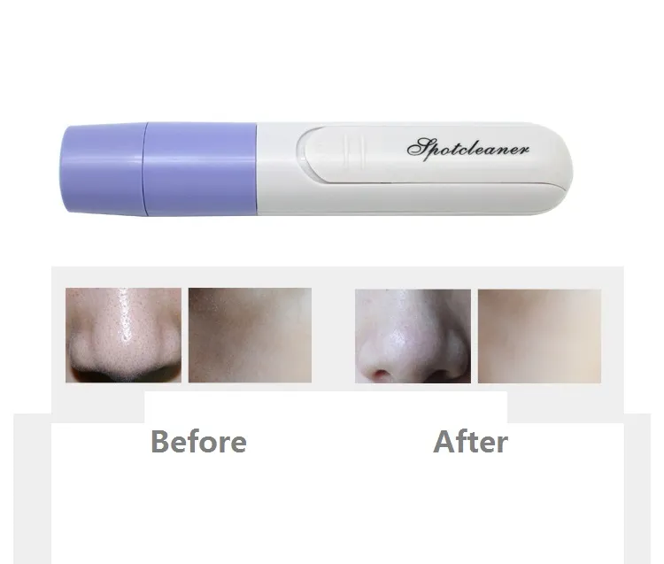 Commercio all'ingrosso Mini Electric Facial Pore Cleanser Detergente la pelle Face Dirt Suck Up Vacuum Acne Brufolo Tool Remover Comedone Clean Massage tools