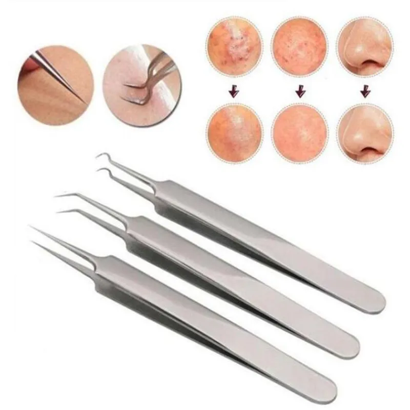 Stainless Steel Acne Needle Blackhead Removal Needle Tweezers Face Care Beauty Repair Tools Clip Acne Remover OOA2150