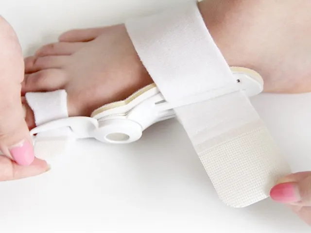 Joanete Splint Toe Corrector Hálux Valgo Alisador Longo Alívio Da Dor Do Pé Dia Noite Correção Ferramenta de Cuidados Com Os Pés