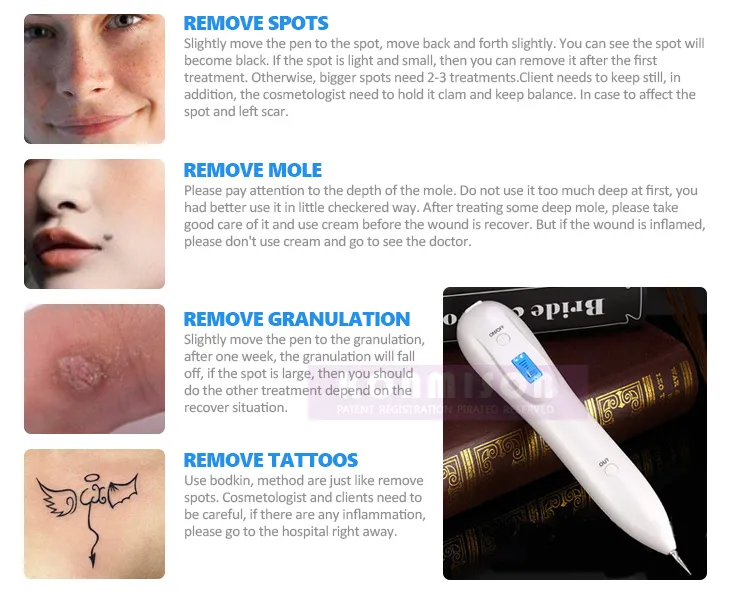 Ручка для удаления папиллом инструкция. Mole removal Pen инструкция на русском. Ручка для удаления татуировок. Spot removal Pen my-035 инструкция. Инструкция по удалению тату плазменной ручкой.