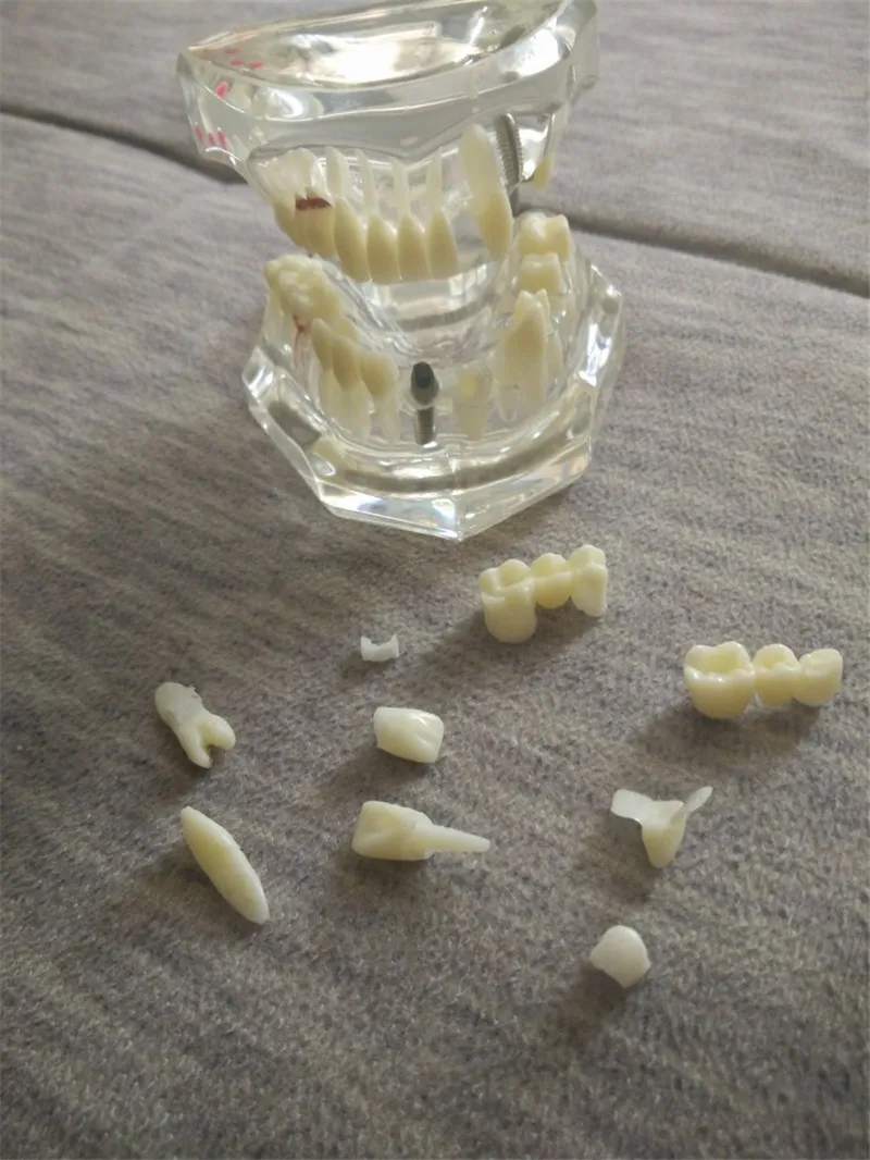 VENDITE CALDE Igiene orale denti in plastica di dimensioni naturali modello di denti rimovibili