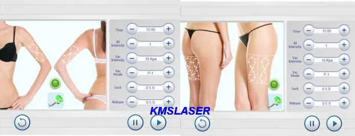 Touch screen Vacuum suction 80Kpa RF LED facial care breast lifting salon spa skin rejuvenation weight loss machine