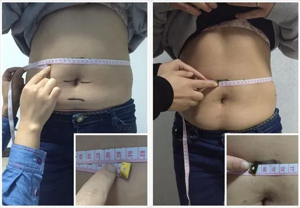 المهنية المزدوج رؤساء liposonic ultrashape السيلوليت إزالة تشكيل التخسيس ultrashape الجمال صالون المعدات