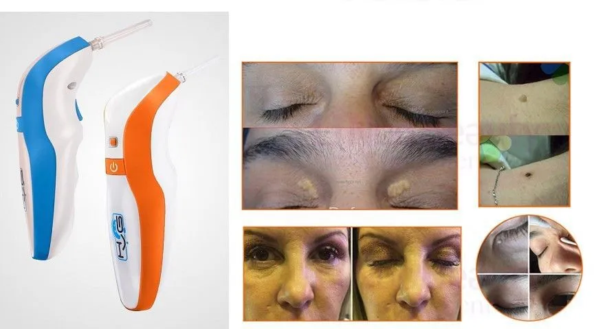 Stylo Laser Plasma pour enlever les taches foncées de la peau du visage, les grains de beauté, les tatouages, les taches de rousseur, les verrues, soins de beauté