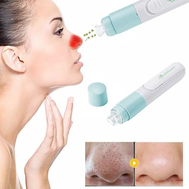 Mini Handheld Facial Blackhead Vacuum Suction Face Skin Protection Pore Cleansing Device Zit Acne Remover Cleaner Machine 4 Colors
