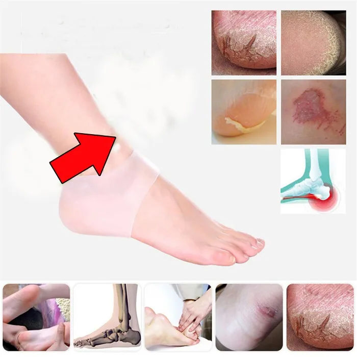 Meias de cuidados com os pés Silicone Gel Hidratante Calcanhar Meias Rachado Pé Cuidados Com A Pele Protetores anti rachaduras