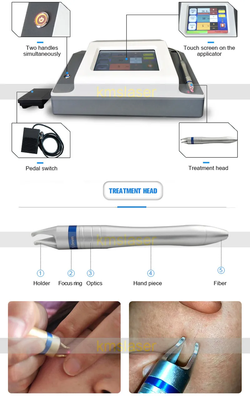 En behandling Se effekter 5 Spotstorlek för option Portable pekskärm 980nm diod laser vaskulär borttagning Spindelveinborttagningsmaskin