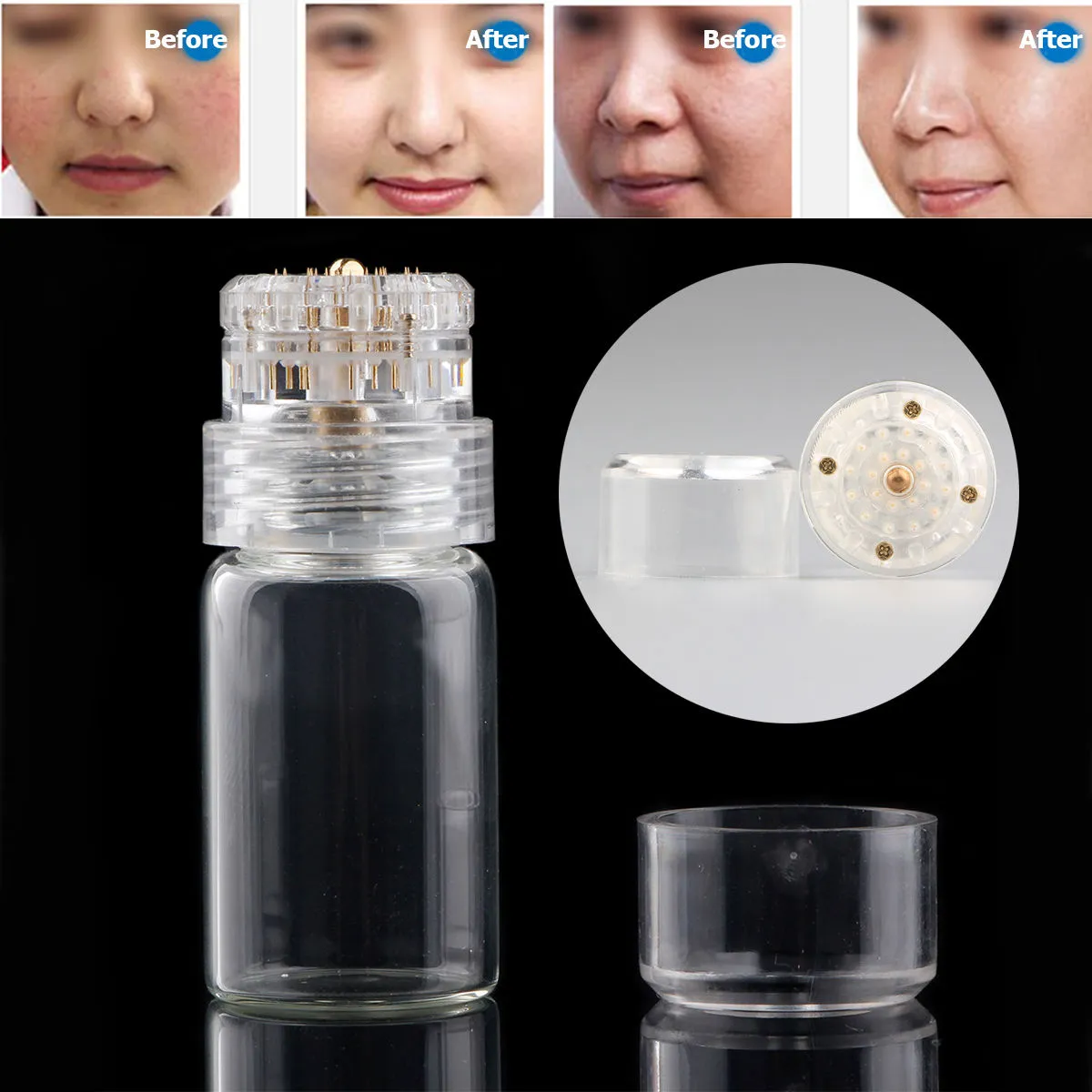 Hydra Naald 20 pins Titanium Microneedle Mesotherapie Huidverzorging Verjonging Whitening Anti Rimpel Derma Stempel Serum Applicator