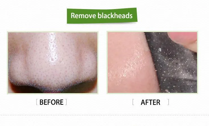 Shirs Black Mask Shills Deep Cleansing Blackshills Face Pore Cleaner 50ml Blackhead Facials Snabbt fartyg