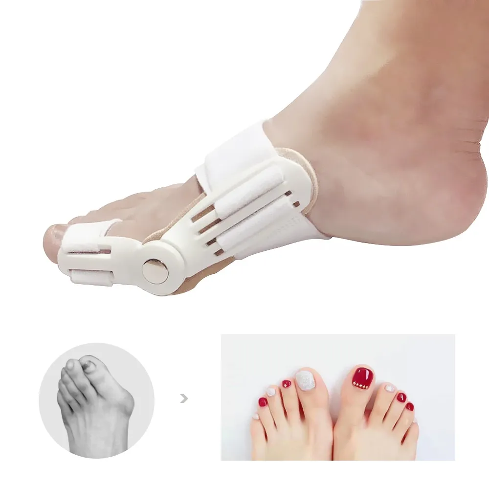 Bunion Aid Hinged Splint Toe Straightener Corrector Brace Brace Bunion