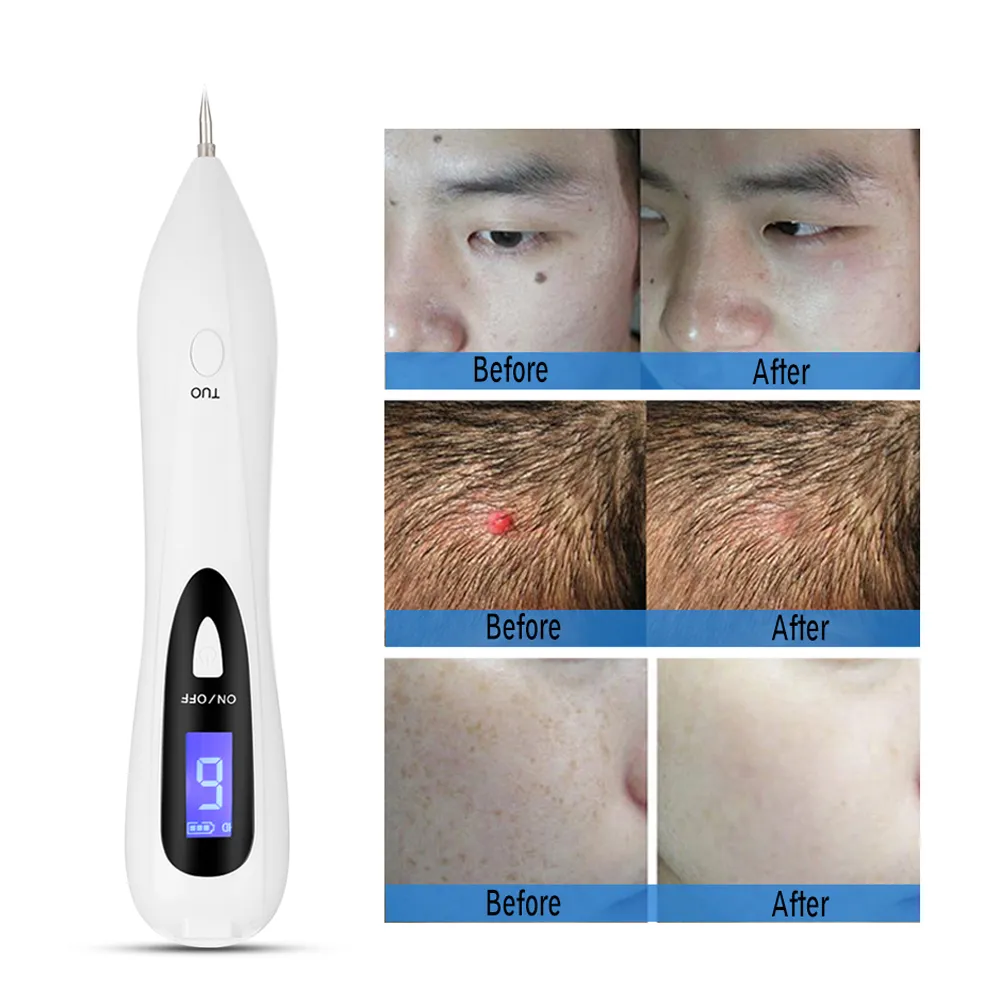 Newest Laser Plasma Pen Mole Removal Dark Spot Remover LCD Skin Care Point Wart Tag Tattoo Tool Beauty