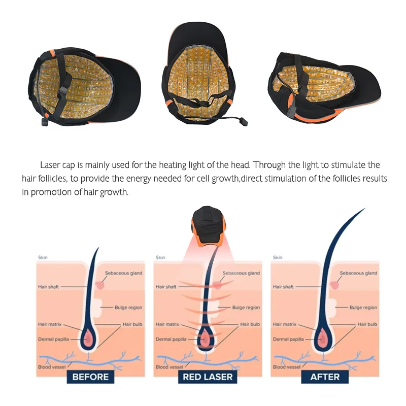 Modelo de máquina láser para el crecimiento del cabello, producto para el crecimiento del cabello, terapia de luz led, tapa de diodo de 650nm