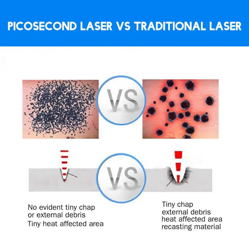 Macchine portatili la rimozione del tatuaggio Prodotti di bellezza Cicatrici Sopracciglio Eyelines Rimuovi la penna laser a picosecondi 110-220 V uso domestico