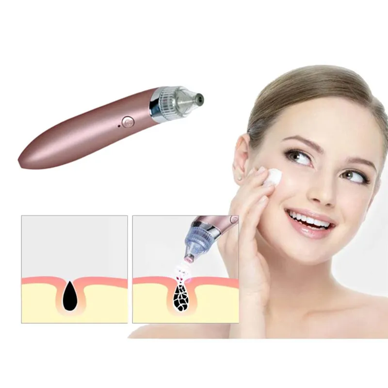 Rosto nariz Acne Preto Dot Pimple Blackhead Remover elétrica Blackhead Vacuum Cleaner Pore Skin Care máquinas-ferramentas 4 dicas