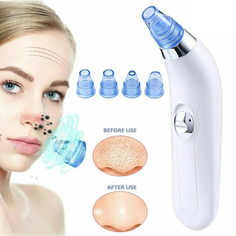 Vacuum Blackhead Remover Nose Facial Pore Cleaner Suction Black Dot Acne Black Head Pimple Remover Beauty Face Skin Care Tool