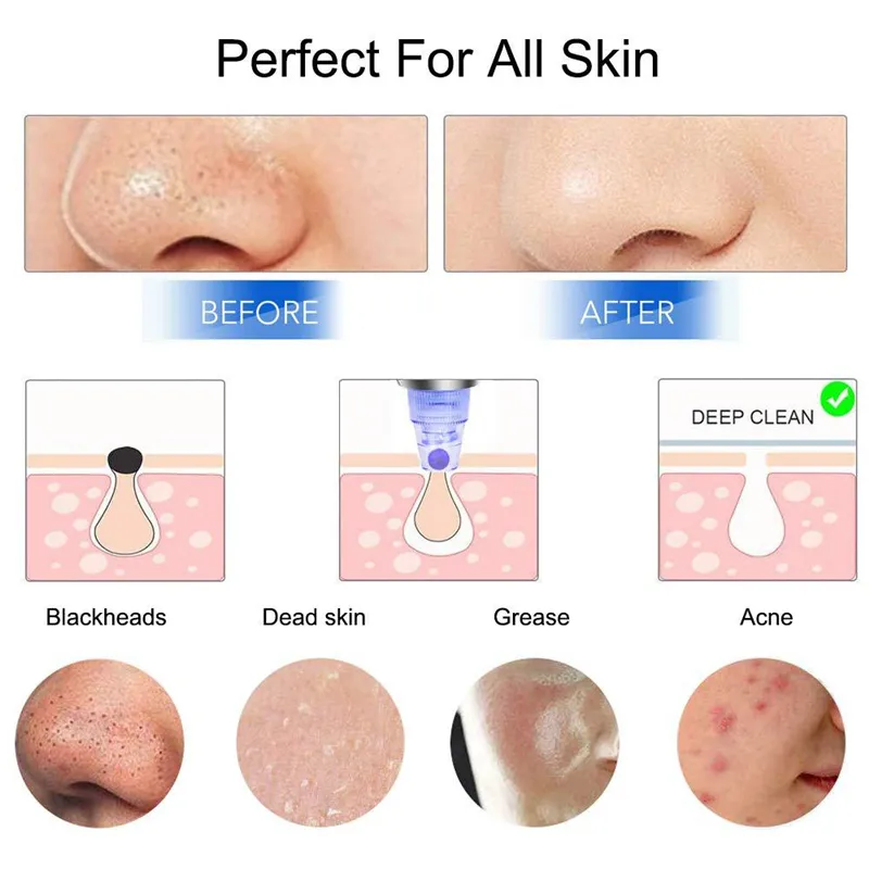 DHL Electric Blackhead Remover Vacuum Suction Nose Facial Pore Cleaner Cleansing Blackhead Removal Tool Machine Skin Care Beauty Instrument