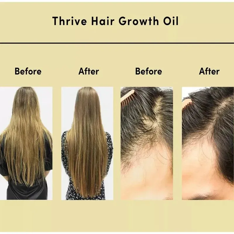 Products Powerful Hair Growth Oil Hair Care Massage Essential Oil Promote Growth and AntiShedding Improve Dry and Frizzy