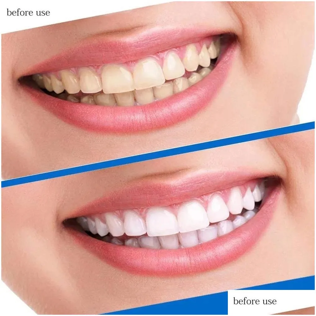 Teeth Whitening Strips 14 Pouches 28 Strip Oral For Stains Removal
