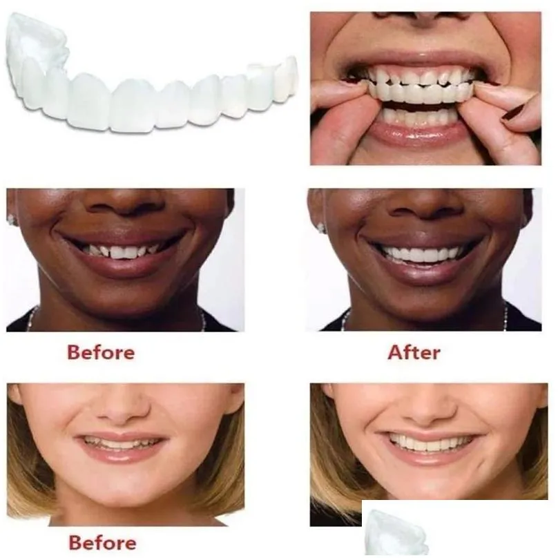 Other Oral Hygiene False Dental Braces Tooth Cover Simulation Chewing Braces Dental Beauty Correction Shaping Universal Dental Defect Repair Braces