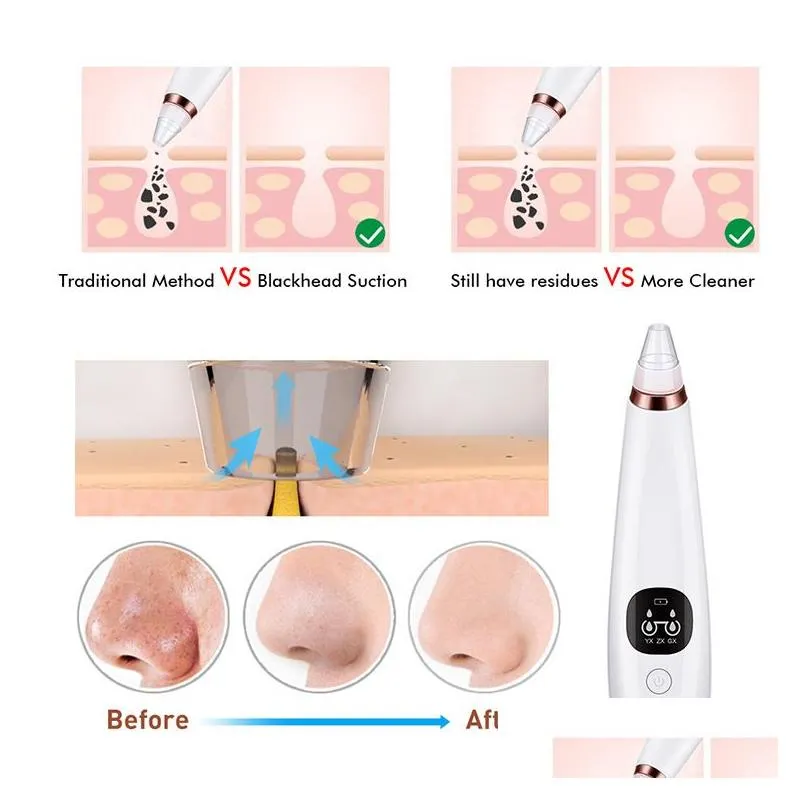 Other Festive & Party Supplies 6 Replace Heads Deep Pore Cleanser Device Rechargeable Drop Delivery Home Garden Festive Party Supplies Dhuh6