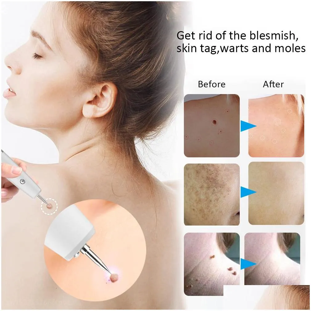 Face Care Devices Skin Tag Mole For Dark Spots Laser Plasma Pen Electric Blemish Wart Lcd Freckle Eliminator Black Dots Removal Drop Dh7Np