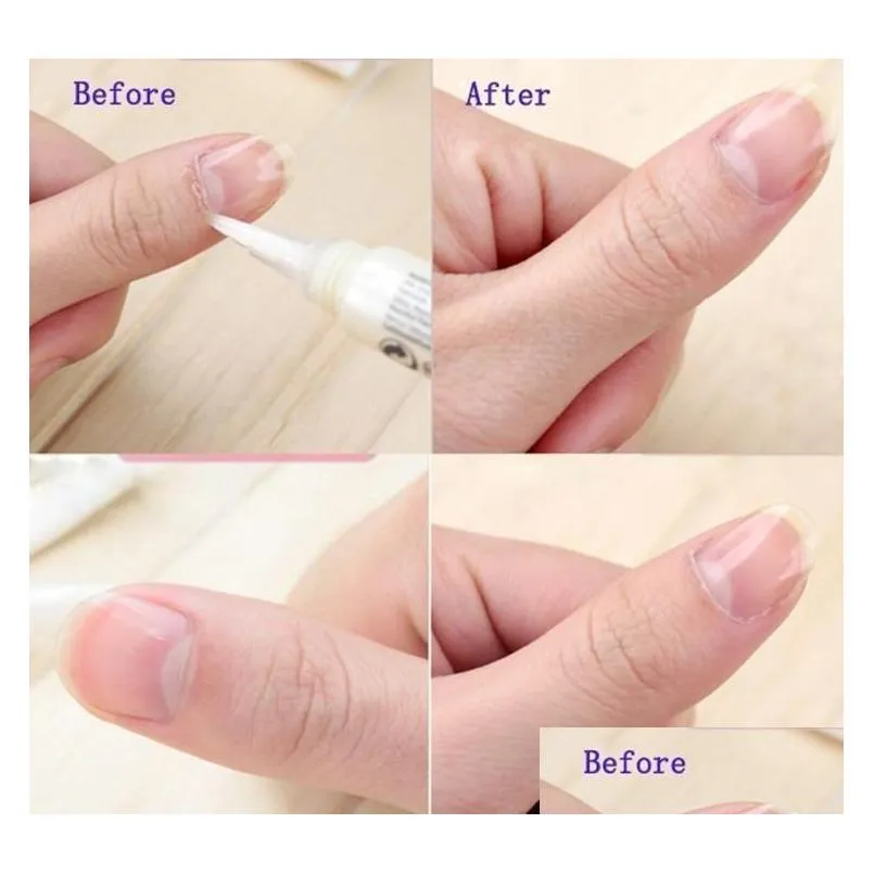 drop cuticle revitalizer oil fruits nail art treatment manicure soften pen tool nail cuticle oil for nail tips makeup tools