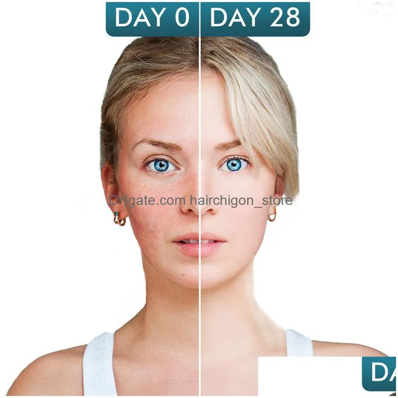 mabox retinol 3% moisturizer face cream lotion vitamin e collagen anti-aging remove acne face serum 50ml