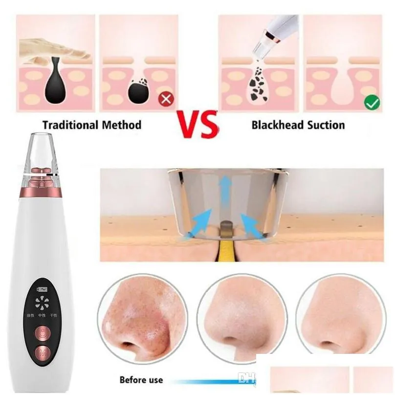 usb blackhead black dot remover face pore vacuum skin care acne pore cleaner pimple removal vacuum suction facial tools