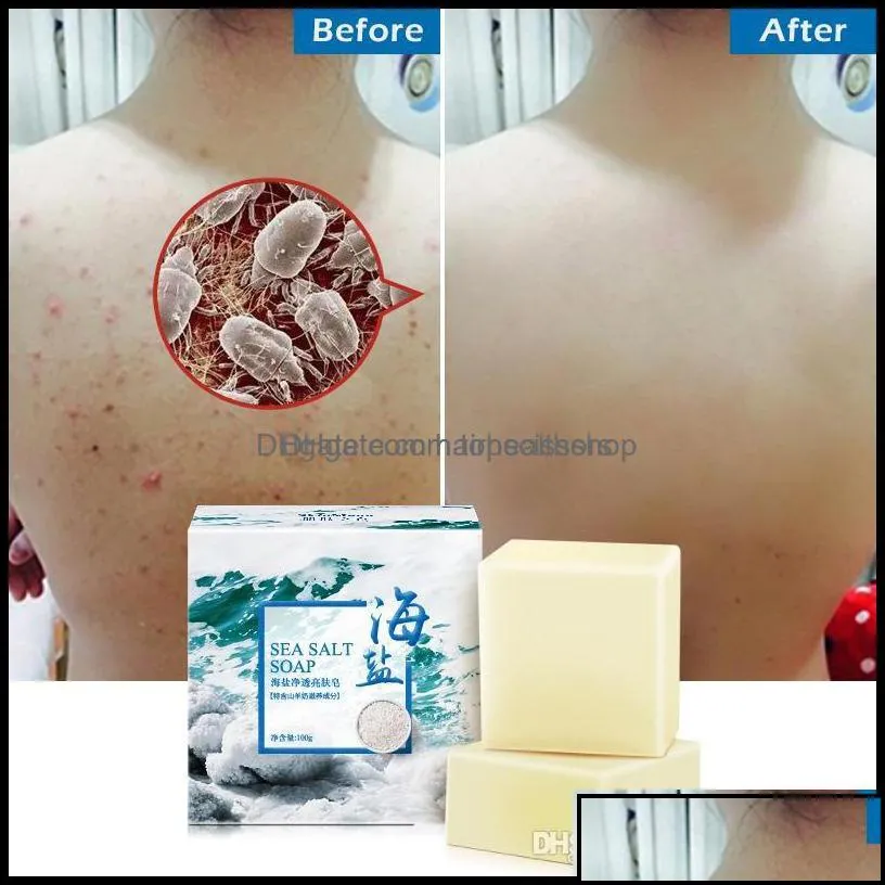 handmade soap bath body health beauty 100g removal pimple pores acne treatment sea salt cleaner goat milk moisturizing face c dhyks