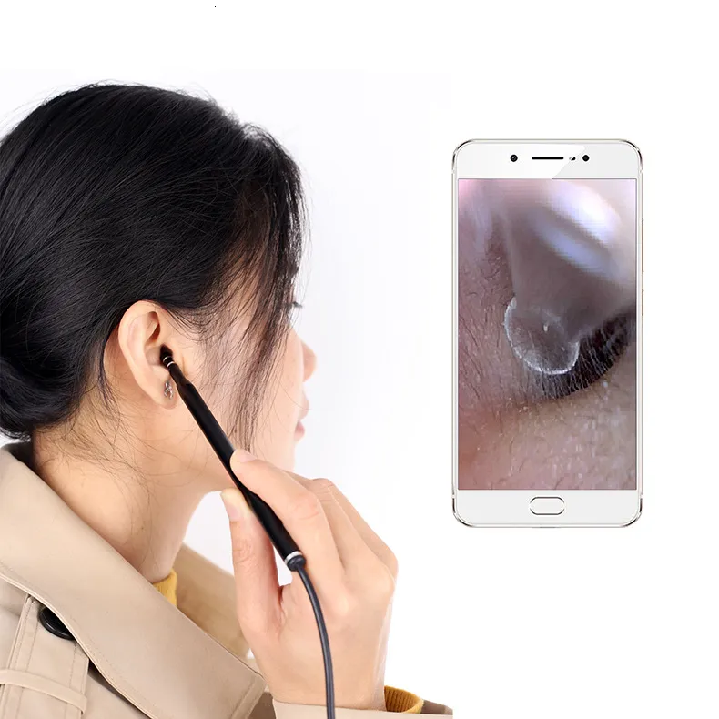 Android PC IOS ad alta risoluzione USB endoscopio otoscopio visione orecchio strumento di pulizia fotocamera endoscopio uso medico