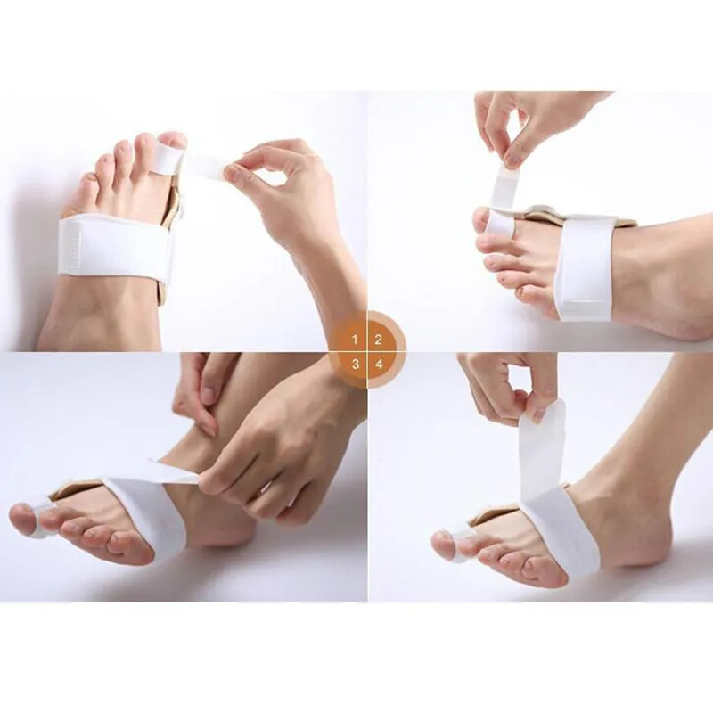 DHL-Bunion Device Hallux Valgus Pro Braces Feet Care Thumb Hallux Valgus Braces Toe Separator Toe Braces Separateur D'Orteils