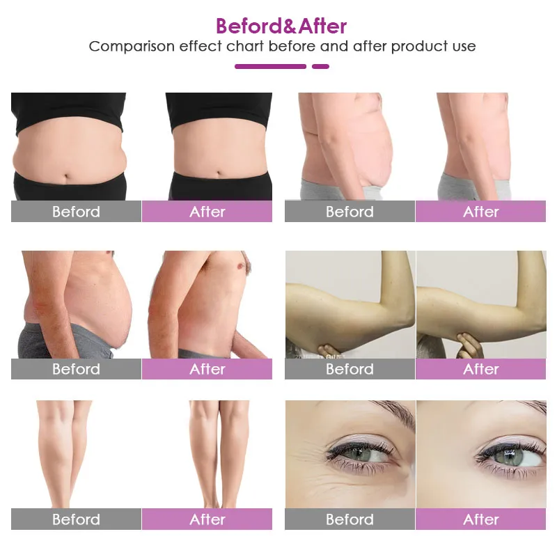 EU belastingvrije nieuwe lipolaser vet afslanken apparatuur diode lipo laser 6pads lipolyse cellulitis gewichtsverlies snelle slanke lichaam vormgevende machine