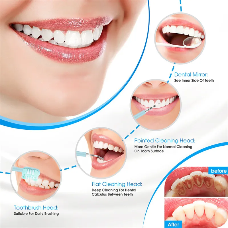Tandheelkundige Tanden Bleken Tandsteen Remover Ultrasone Reiniger Elektrische Tandenborstel Steen Verwijderen Monddouches 220225