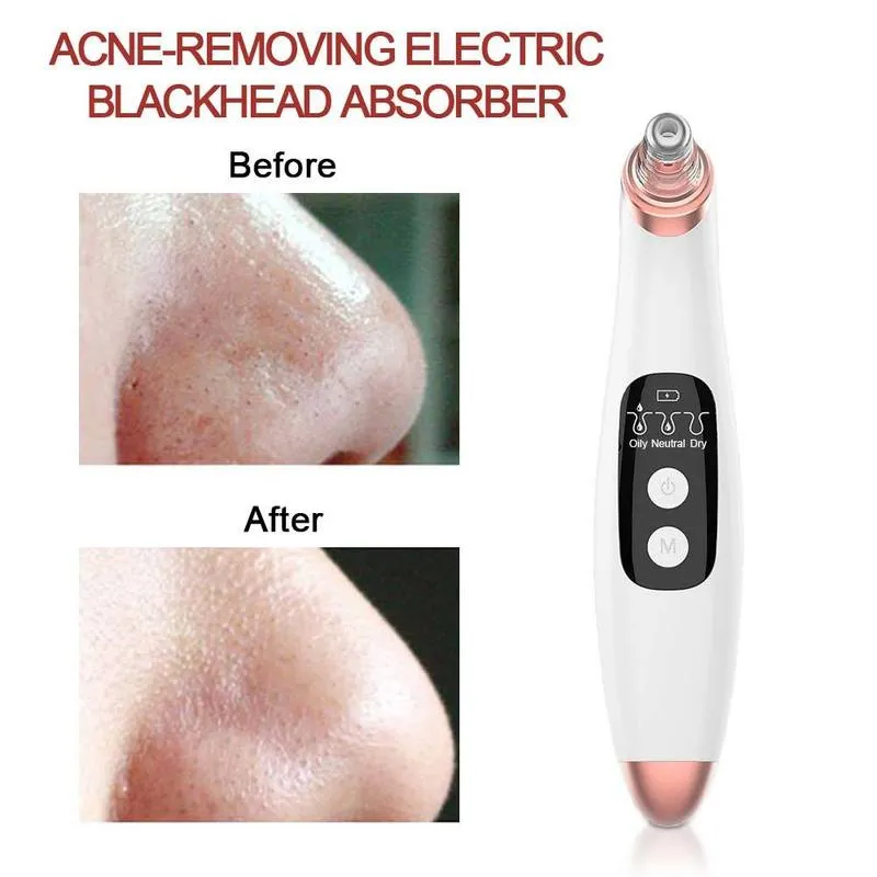 Dispositivo la rimozione dei punti neri Dispositivo la pulizia dei pori elettrico l'acne Strumento l'aspirapolvere Macchie Macchina la cura della pelle 26