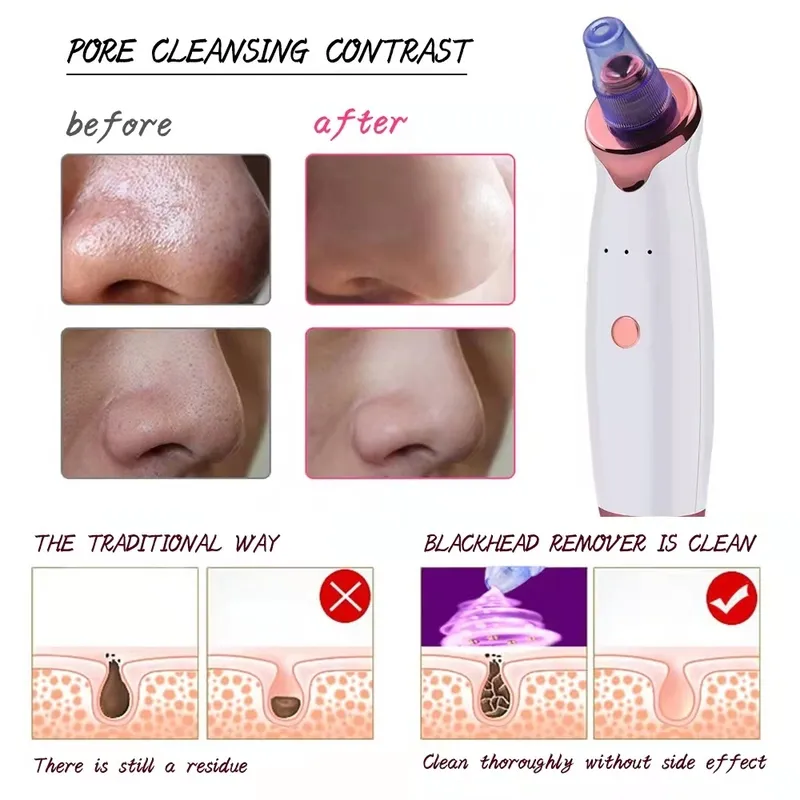 Blackhead Remover Electric Pore Cleaner Face Deep Nose T Zone Acne Pimple Removal Vacuum Suction 26