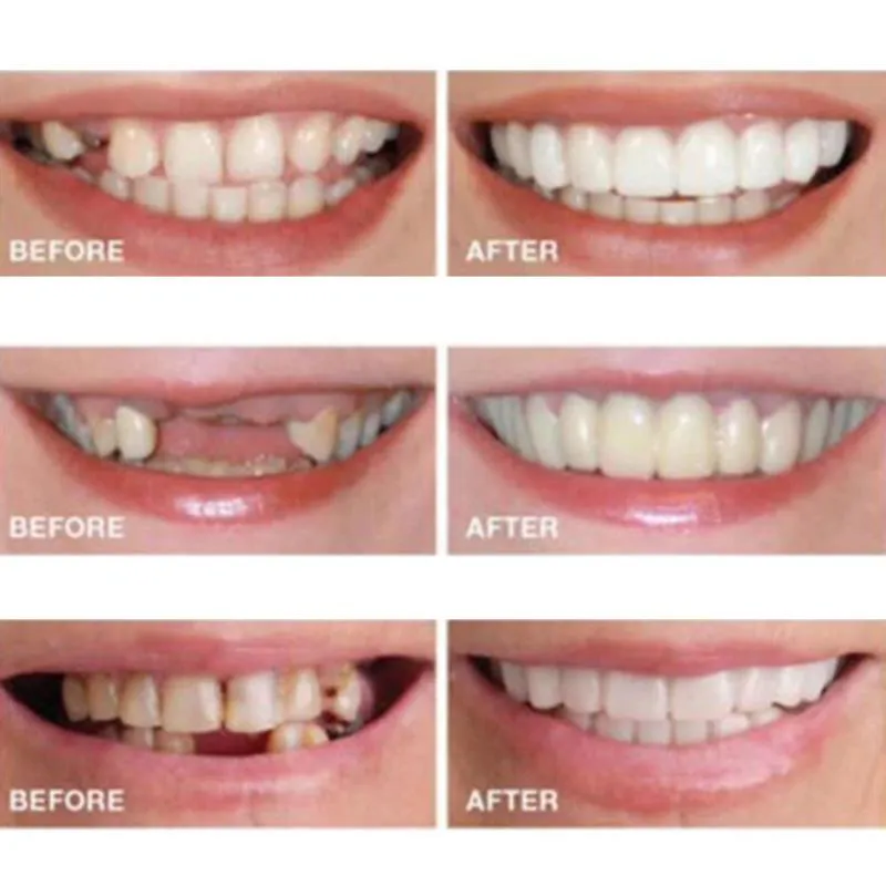 Partybevorzugung 1 Paar Silikon-Fälschungszähne Obere falsche Zahnabdeckung Lächeln Prothesenpflege Orale Kunststoffaufhellung283k