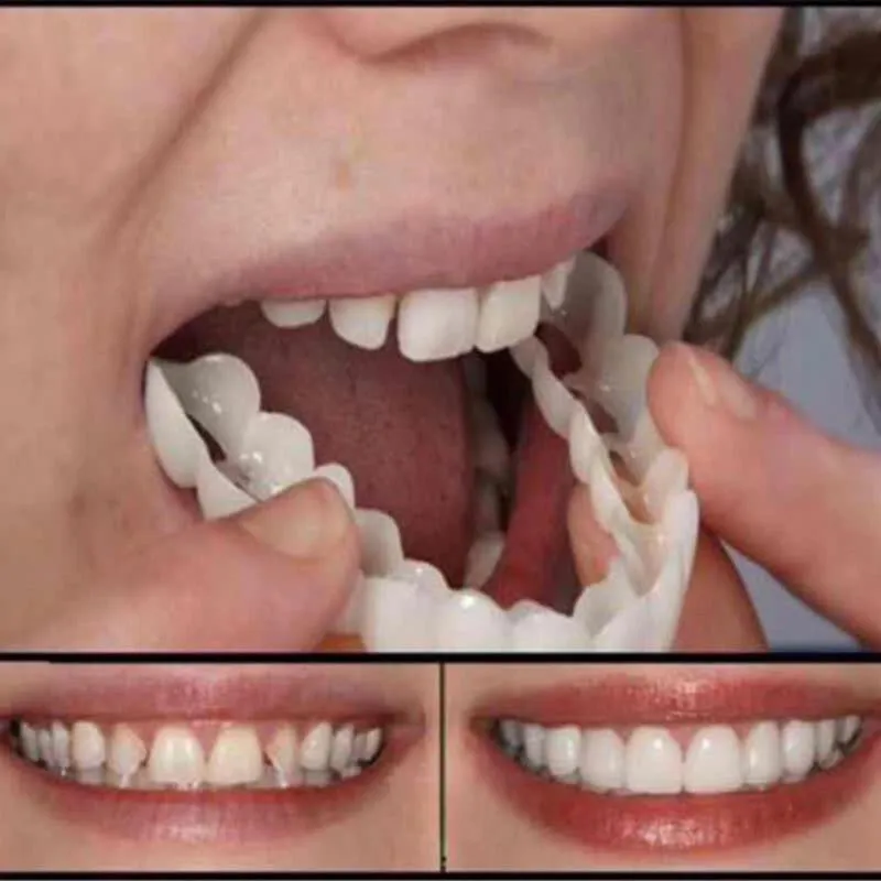 e de fausses dents en silicone, couverture supérieure de fausses dents, sourire, soins dentaires, plastique buccal, blanchiment 263d
