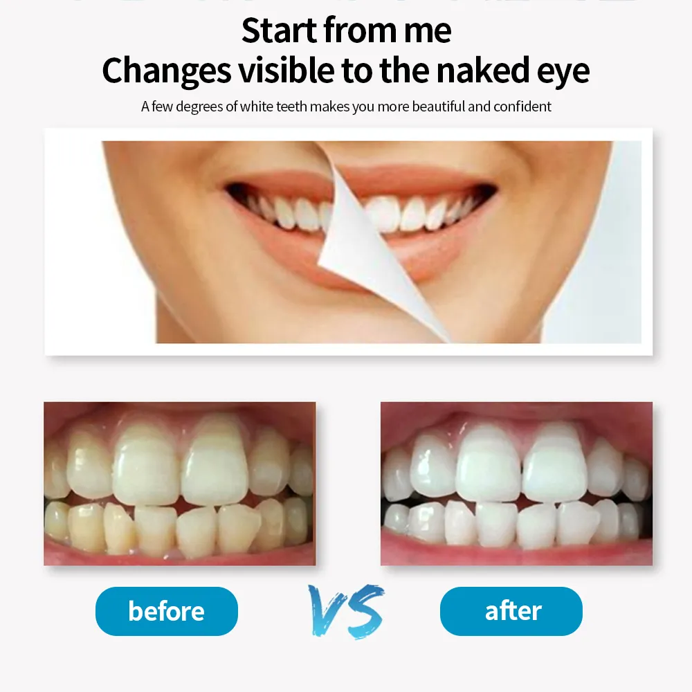 Elektrische ultra tandheelkundige scaler LED -display Tandcalverus Remover Cleanere tandvlekken Tartaargereedschap Witte tanden Tanden Tartar171A4260653