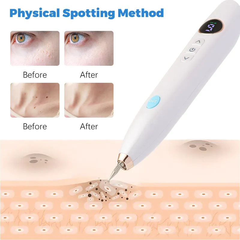 LCD Plasma Caneta Profesional Laser Tatuagem Remoção Mole Care Ferramentas Tag Freckle Wart Dark Spot Removedor Beauty 220224